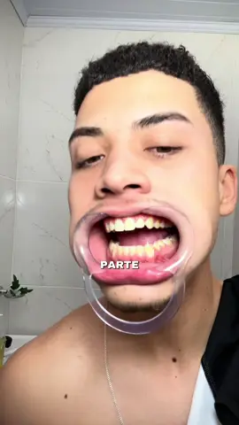 Fiz merda no meu dente 🤦🏻‍♂️
