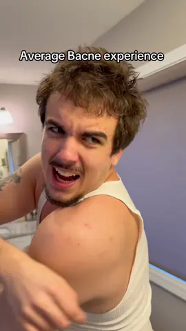 Bacne the worst pain in this earth 