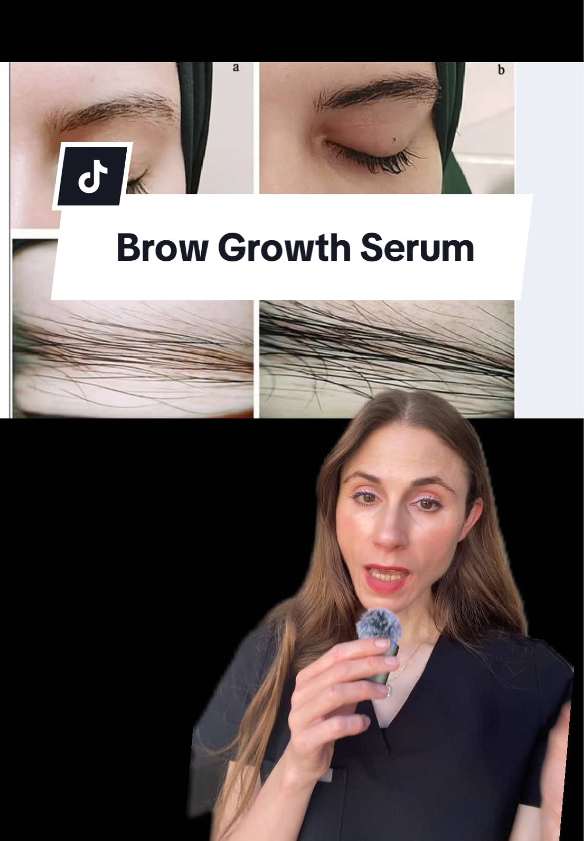 Best serum for eyebrow growth #browgrowthserum #brows #eyebrows #dermatologist #creatorsearchinsights  