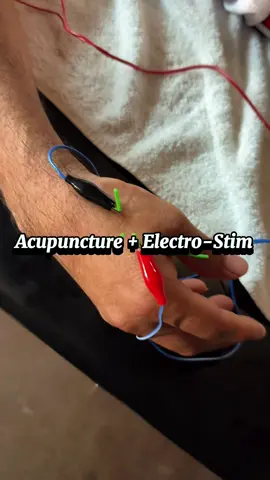 Acu & electro ⚡️ #acupuncture #tendinitis #heal #recovery 