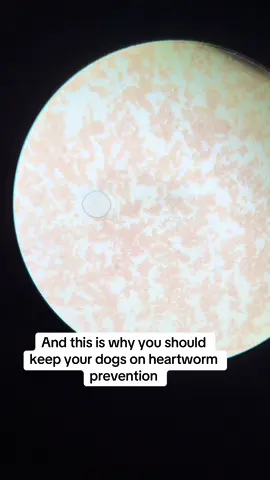 Microfilaria (baby heartworms ) are cool to see but we also don’t like seeing them #veterinarian #vetsoftiktok #vetmed #heartworms 