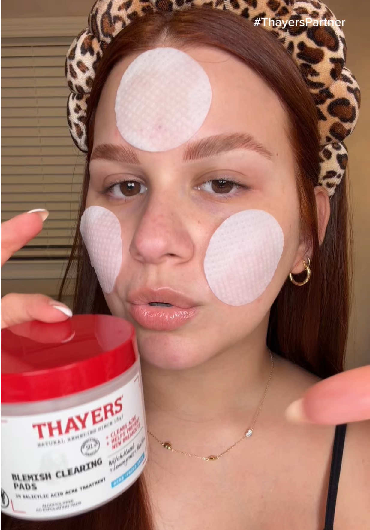 Amamos los productos multi-task ✌🏻✨ @Thayers #thayerspartner #thayersacne #thayersacneproducts 