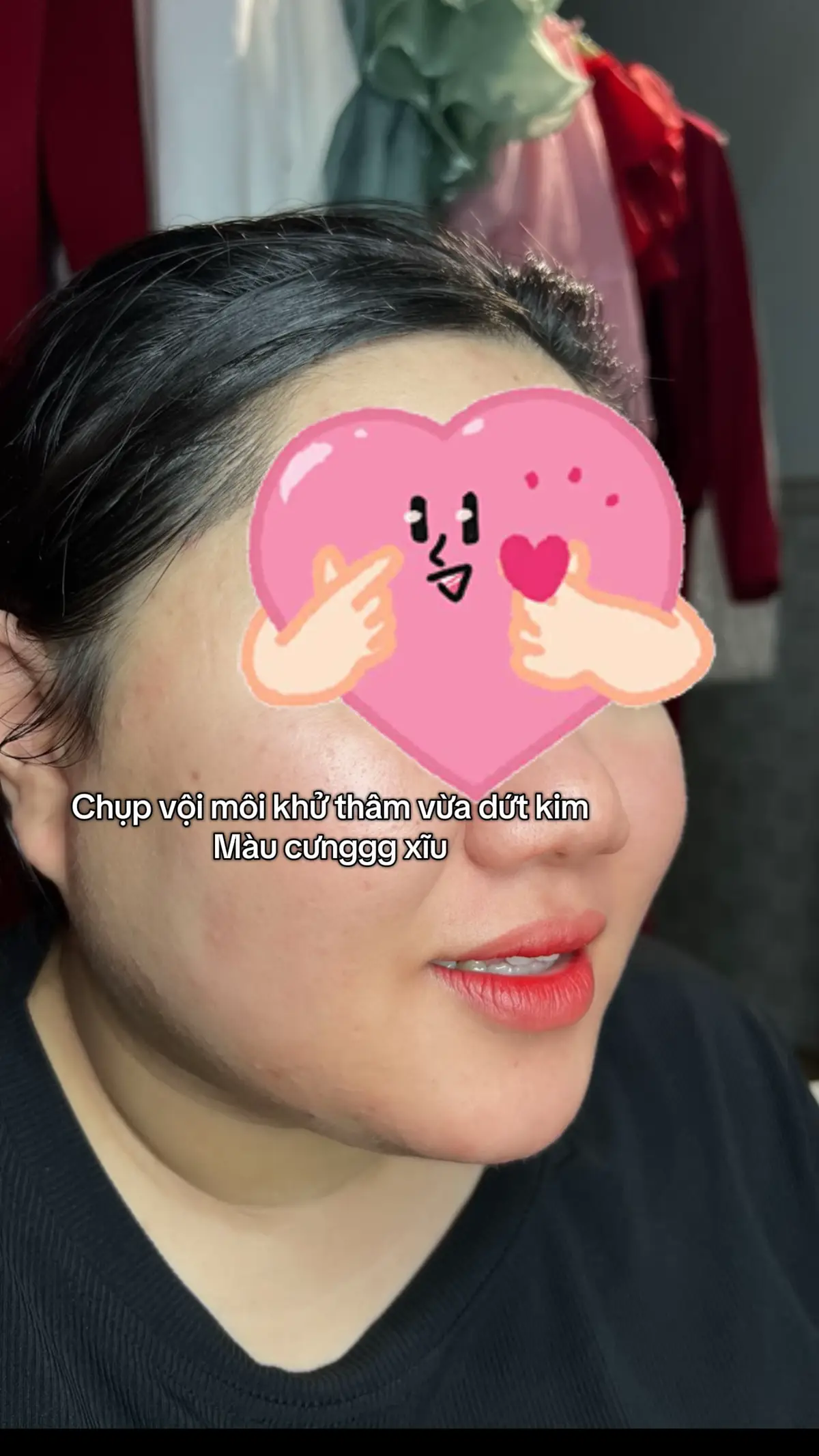 Khách emmmm thích mê mê mê #phunmoitunhien #phunxamthammy #khửthâmmôiđẹpBìnhTân #viral #khuthammoitunhien 