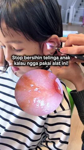 Pembersih telinga ada kameranya nih bun #pembersihtelinga #korekkuping #korekkupingkamera #korekkupingkamerahp 