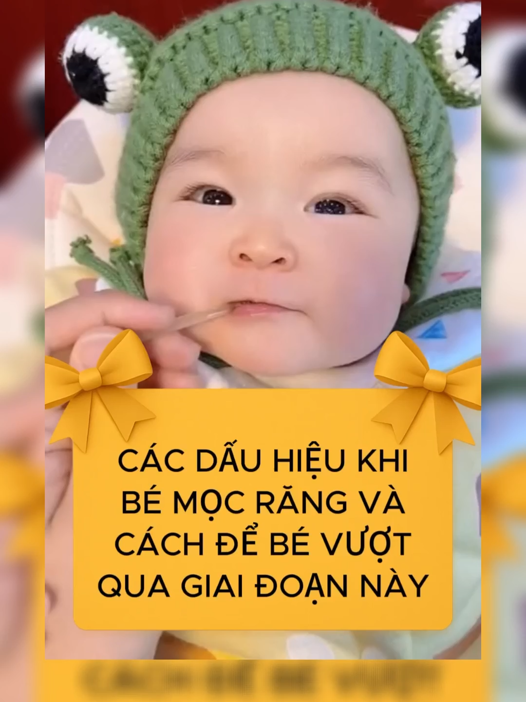Dấu hiệu bé bắt đầu vào giai đoạn mọc răng và cách giúp bé vượt qua giai đoạn này,bố mẹ đã biết chưa #mebimsua #landaulamme #tresosinh #bimsuachamcon #chamconkhoahoc