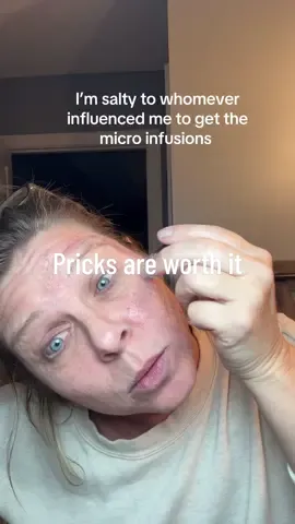 @Qure Skincare why do your micro infusions have me feeling youthful? #microneedling #agingskin #tiktokshopcreatorpicks #tiktokshopblackfriday #tiktokshopcybermonday 