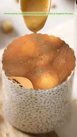 For skincare awareness only #acnetreatment #skincare #oddlysatisfying #glowingskin #fyp 