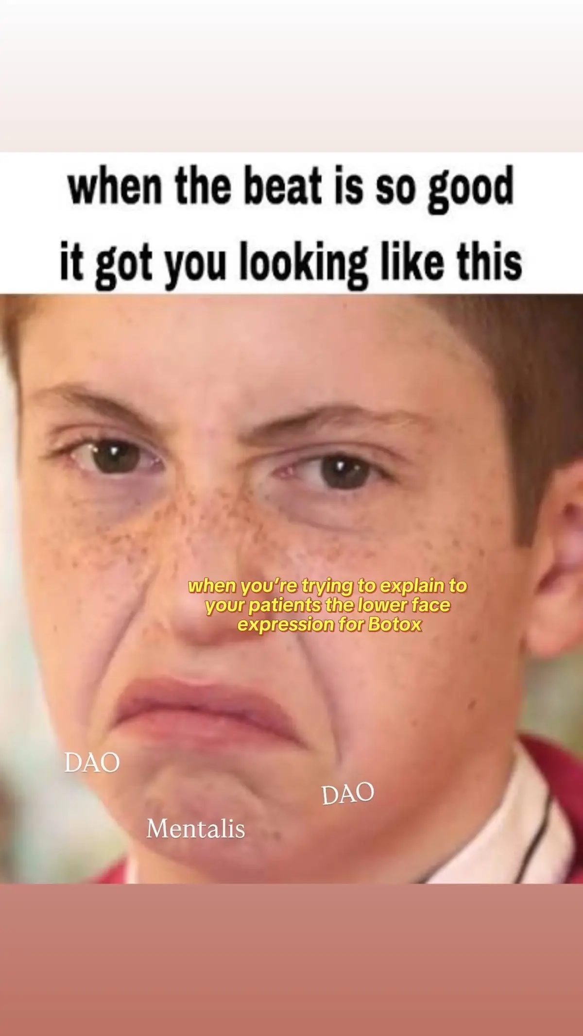 #botox #dao #edmtiktok #aestheticnurse 