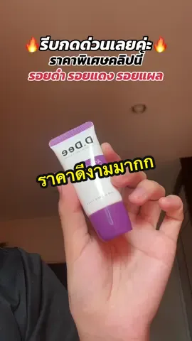 รีบบบเลยค่ะมีนิดเดียวววว #เจลลดรอยสิว #รอยแดง #รอยดำ #ลดรอยแผลเป็น 