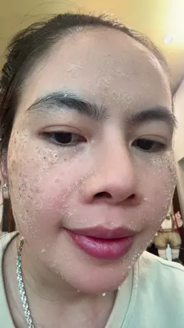 Tinh chất hút sắc tố 5-7 runhj #mun #nam#tàn nhang #xuhuongtiktok #spathutrang97 