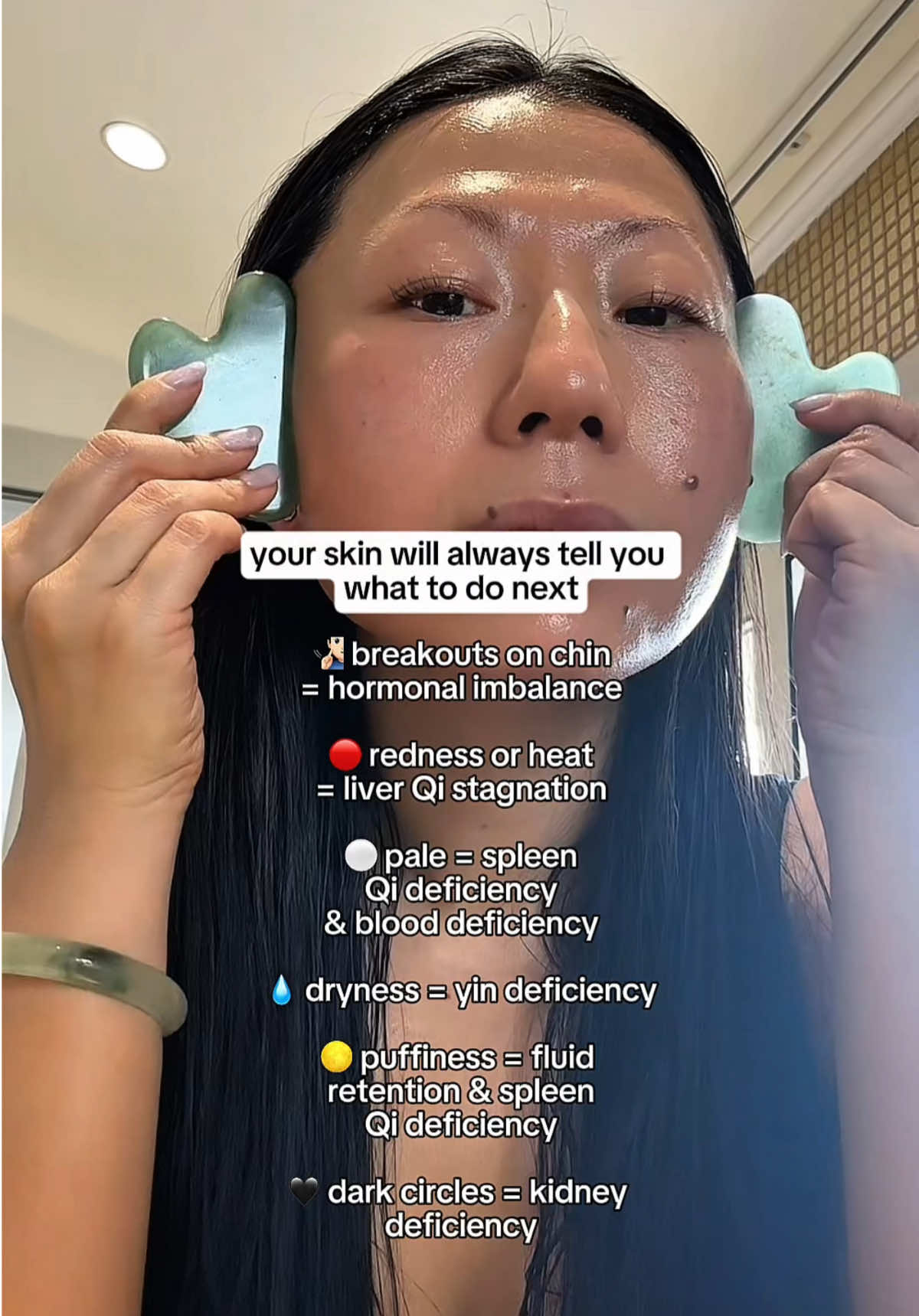 Your skin is always speaking, not just through breakouts, but through color, texture, and tone.⁠ ⁠ In Chinese Medicine, your face reflects what’s happening within: The Spleen, Liver, Kidneys, and Yin all show up in how your skin looks and feels. When you nourish these systems and move Qi smoothly, your glow returns naturally. ✨⁠ ⁠ Save this as a reminder that skincare starts from the inside out. 🤗⁠ ⁠ #tcmbeauty #skinhealth #chinesemedicine #naturalhealing #holisticbeauty  