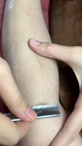 Cạo #chamsocdamun#chamsocdaseo#chamsocdanam#tanbinh#Lqspa 