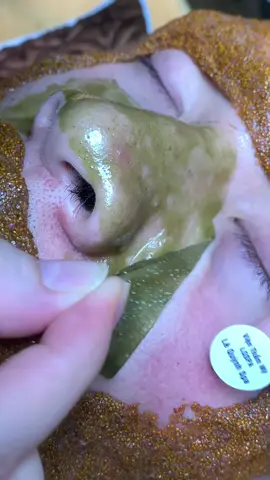 Mềm #chamsocdamun#chamsocdaseo#chamsocdanam#tanbinh#Lqspa&academy