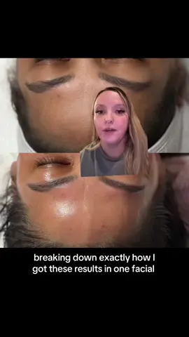 @Circadia this was so satisfying #esthetician #soloesthetician #estheticianlife #estheticiantiktok #circadia 