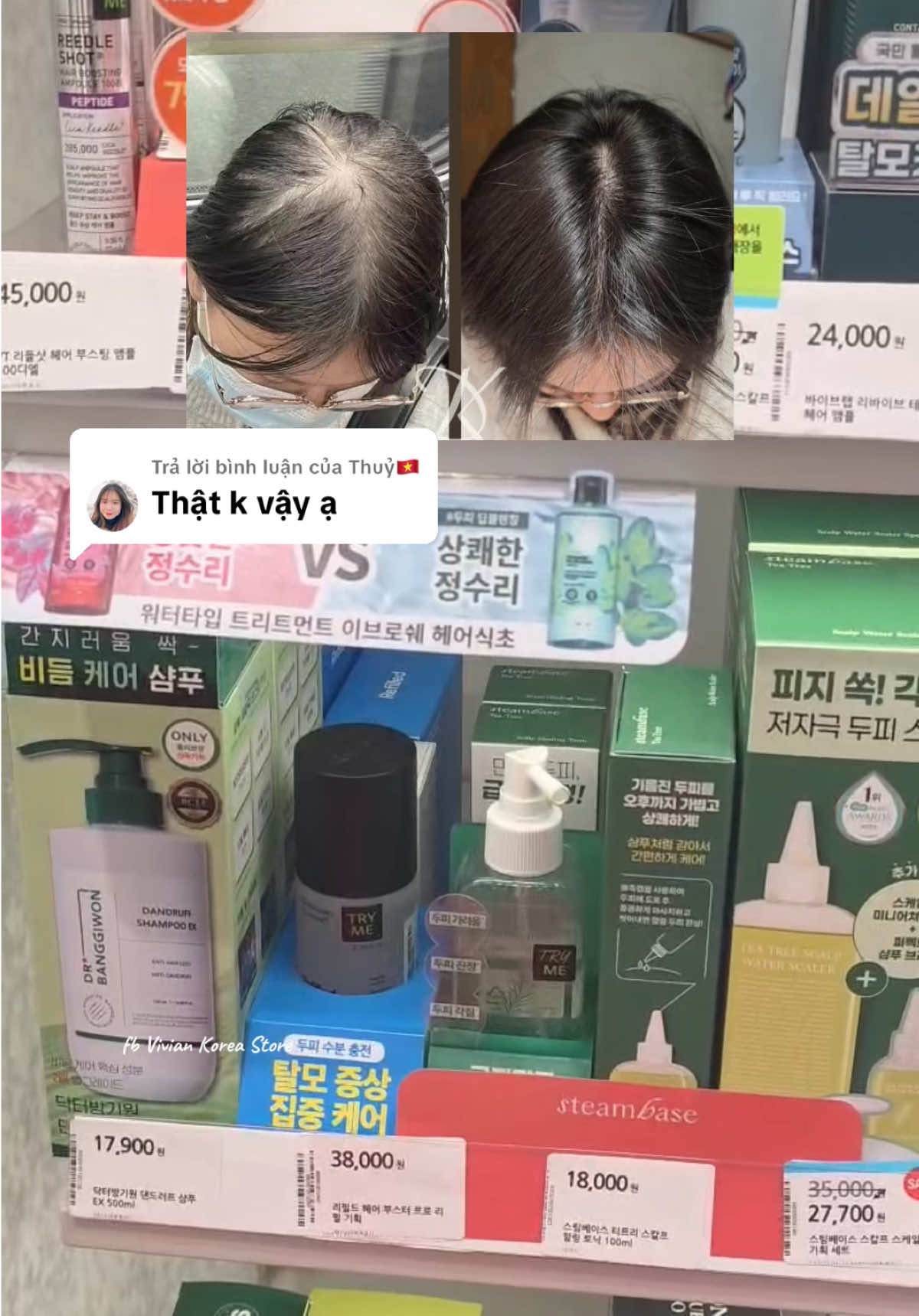 Trả lời @Thuỷ🇻🇳 tóc mọc râm ran da đầu #thuocmoctoc #minoxidil #oliveyoung #hieuthuochanquoc 