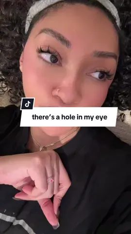 So I have a hole in my eye, if you see floaty thingys or flashes of light you might too? Calling a specialist tomorrow! Obviously want to update what the heck happens know in hopes of helping someone out… we shall see. Okay by love you. 