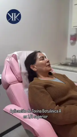 El combo + solicitado en la clinica, toxina botulinica para eliminación de arrugas y lineas de expresión y PDRN salmon para renegeracion celular de la piel 