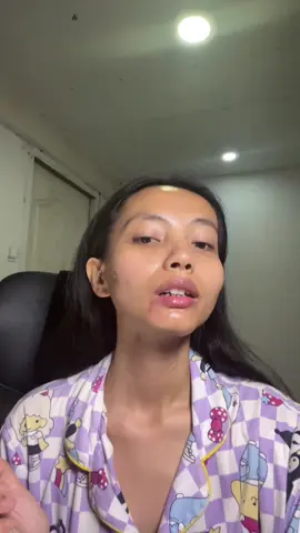 #คอเป็นเส้น #คอดำ  #คอไหม้แดด  #เรตินอลคอ  #เรตินอลคอครีม 