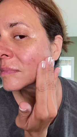 My under eyes haven’t looked this smooth in years! This Doctor Melaxin CEMENRETE balm stick + eye patches combo is the real Korean skincare secret — instant depuffing, glow, and lift. Use it before bed and feel your skin feel tighter and brighter every morning. #creatorsearchinsights #KoreanSkinCare #AntiagingSkinCare #SkinCareForMatureSkin #dryskincare @Dr.Melaxin Global 