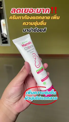 #ครีมทาท้องลาย #ครีมทาท้องแตกลาย #ครีมทาท้อง #มาม่าช้อยส์ #ของดีบอกต่อ 
