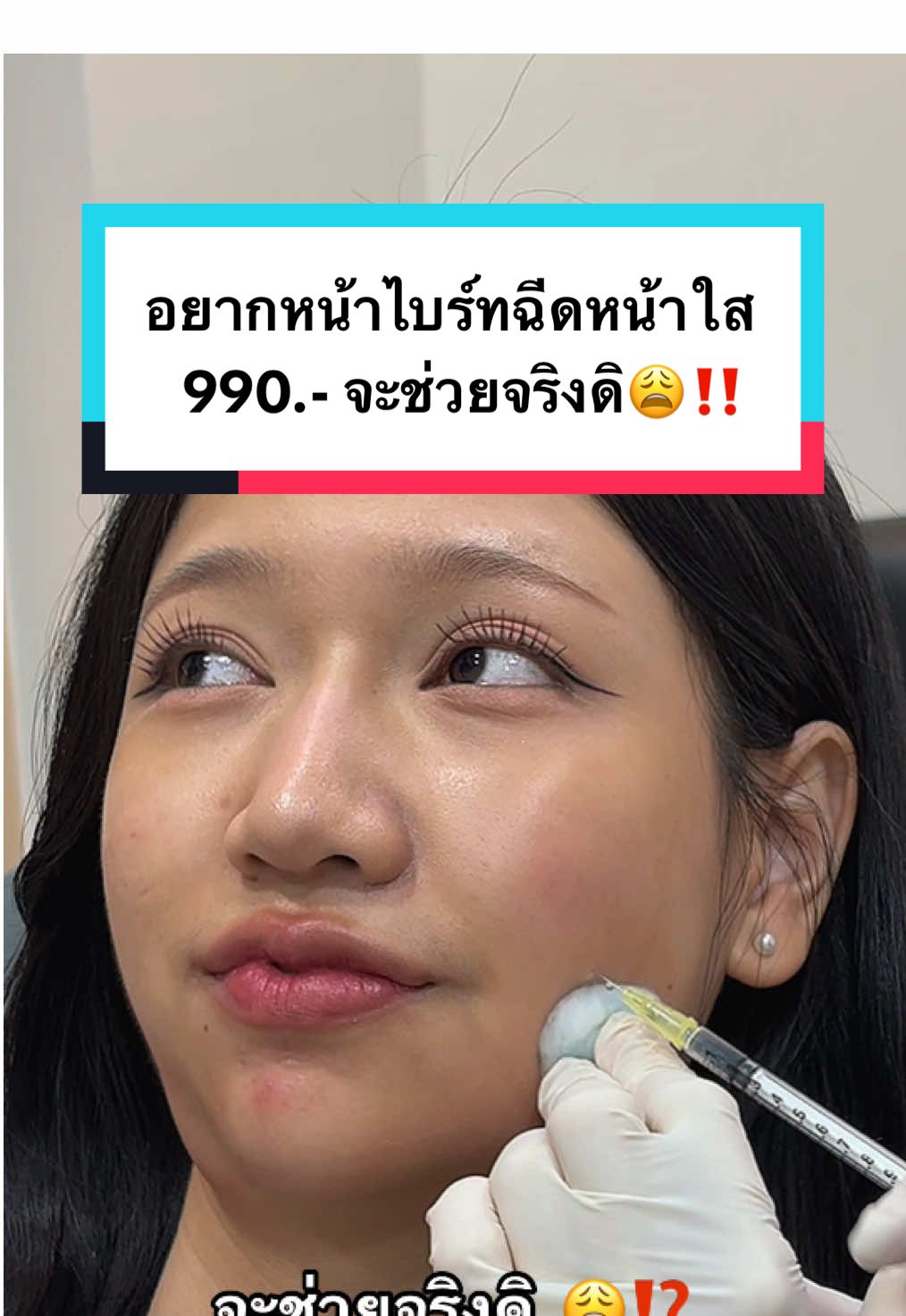 อยากหน้าไบร์ท ฉีดหน้าใส 990.- จะช่วยจริงดิ😩‼️ #AuraXpress #หน้าใส #ฉีดหน้าใส #หน้ากระจ่างใส #หน้าขาวใส 