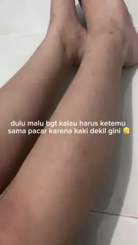 penyelamat gue bangett 🫶🏻🫶🏻🫶🏻 #bekasluka #ciaraindonesia #ruam #creambekasluka #creamgatal 