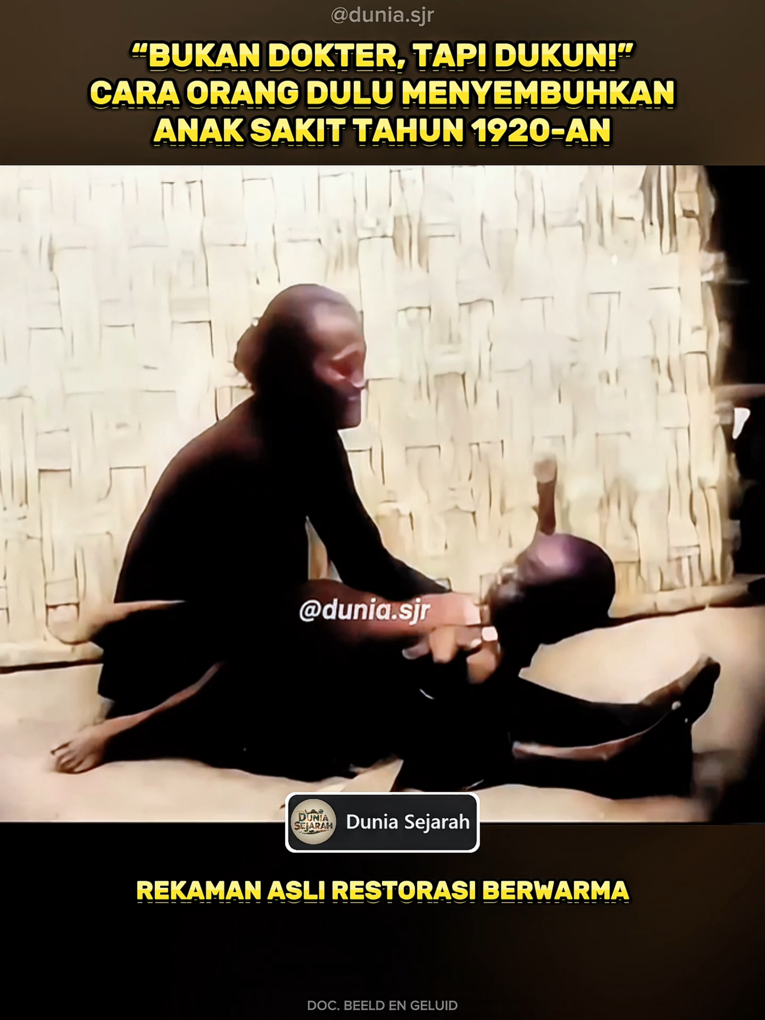 Beginilah cara masyarakat tempo dulu mengobati anak yang demam, jauh sebelum layanan medis modern dikenal luas. Pada tahun 1920-an, terutama di desa-desa Hindia Belanda, dukun perempuan dipercaya memiliki kekuatan penyembuhan, lewat doa, pijatan, ramuan, hingga ritual magis. Suasana rumah bambu, bau minyak kelapa, dan bisikan mantra jadi saksi bagaimana pengobatan tradisional berjalan di masa lalu... #DuniaSejarah #PengobatanTradisional #Dukun #JamanDulu #TempoDoeloe #SejarahIndonesia