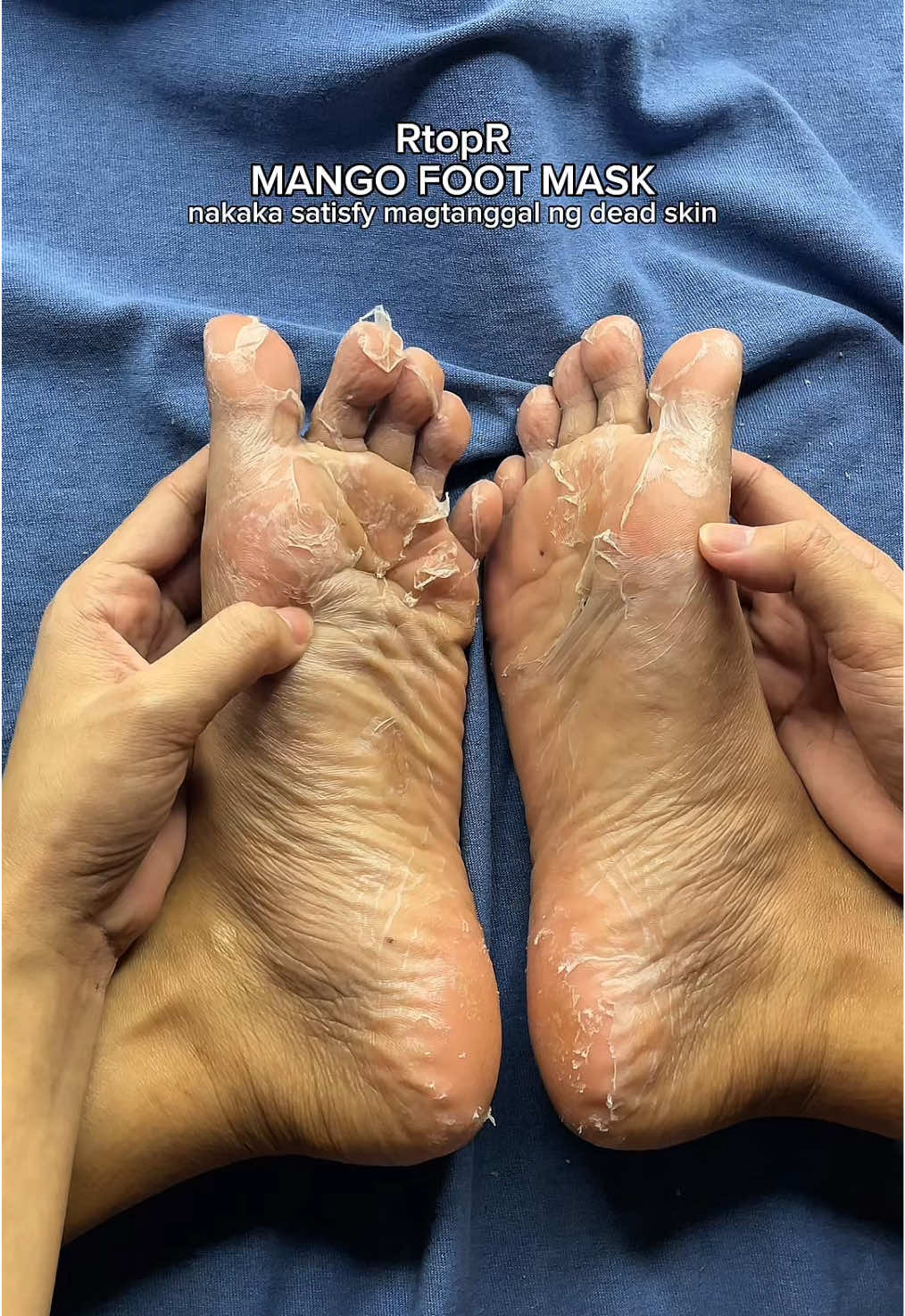 Try n’yo natin ‘to mga miii, grabe nag enjoy ako magtanggal ng dead skin HAHAHA 😂 RtopR MANGO FOOT MASK nasa yellow basket ang link mga sissy 🫶 #footmask #rtopr #rtoprmango #rtoprfootmask #mangofootmask 