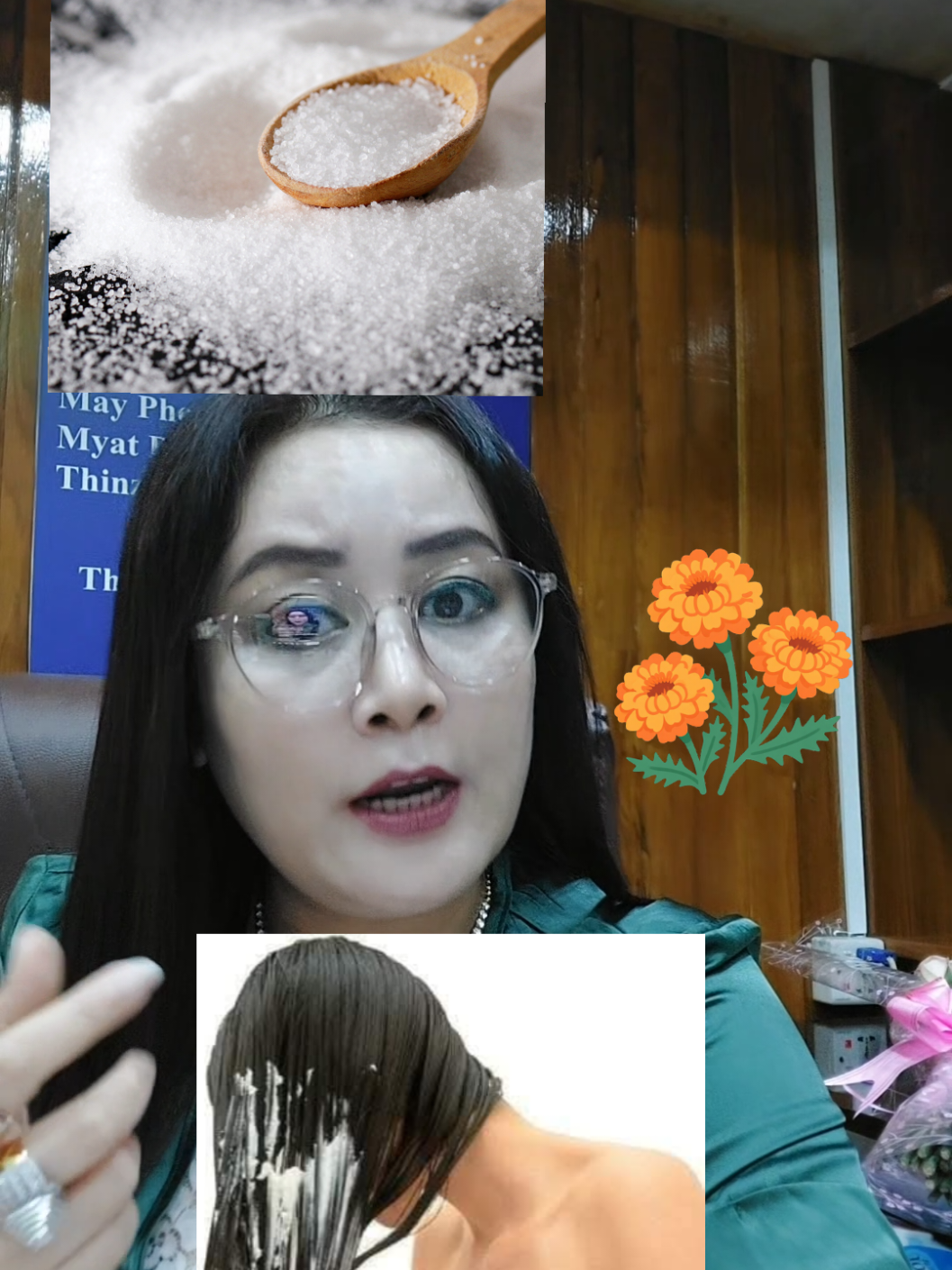 ဗောက်အမြဲ ထနေတဲ့သူတွေအတွက် #အယ်လ်မွန်သင်း #diamondqueen  #ဆံပင်ဗောက်ကြောင့်စိတ်ညစ်နေသူများ #ဆံပင်ကျန်းမာရေး #fyp 