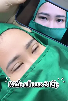 Nhấn mí #nhanmibinhduong #thuanan #binhduong #nhấnmíNano2lớp #taonepmivinhvien 