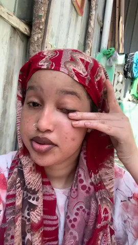 Nayada bishi meeqo bari baa iska xirtan xada wajiga 😂🦦#somalitikto 