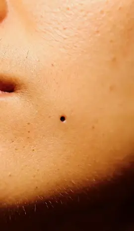 ASMR video #tiktokusa🇺🇸 #asmrvideo #asmrsounds #blackheadremoval #viraltiktok 