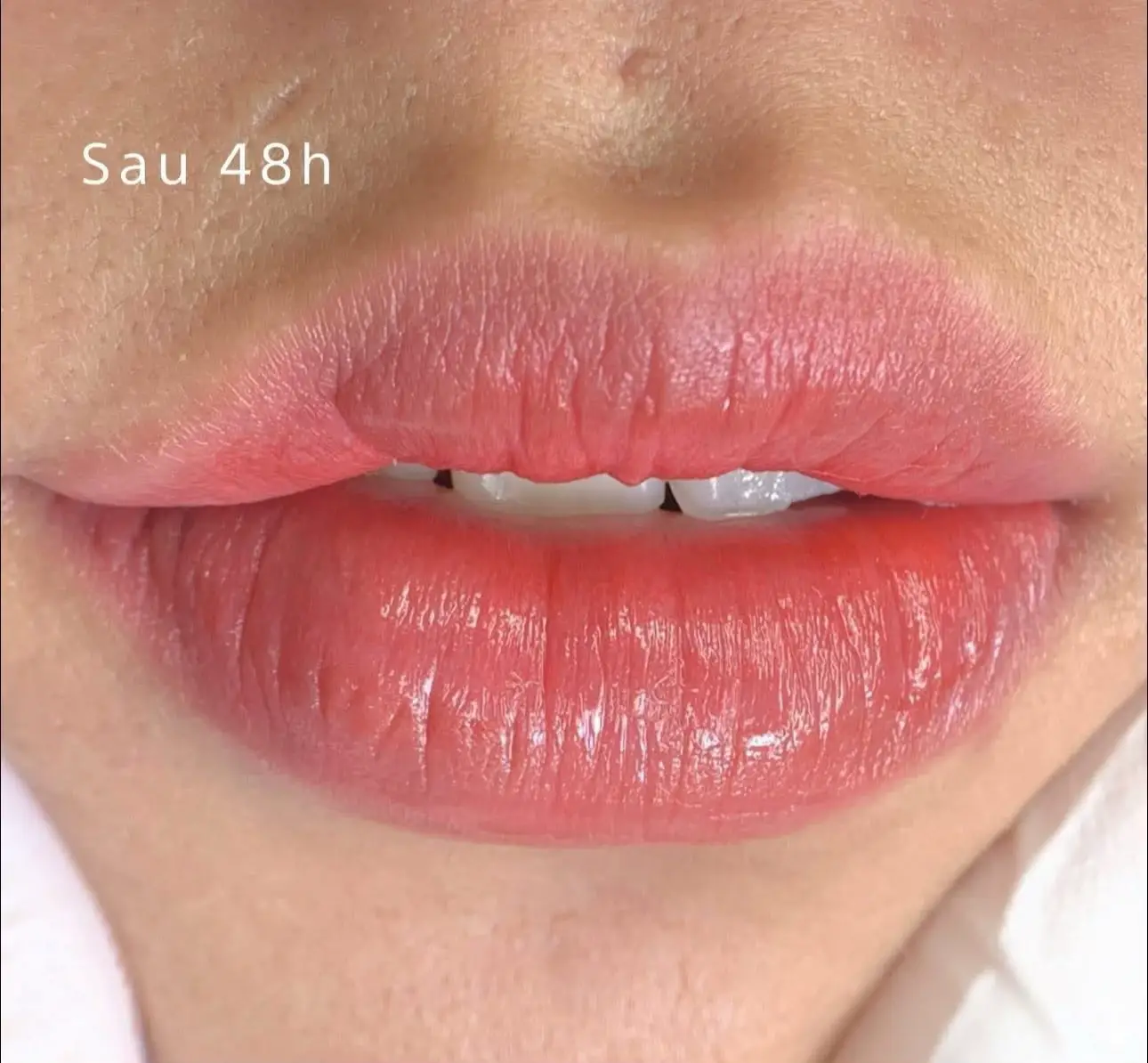 PHUN MÔI KĨ THUẬT MỚI HIỆN NAY ❌ Viền môi nhòe, loang màu, mất nét? ✅ Chỉnh sửa chuyên sâu – Dặm lại viền môi sắc nét tự nhiên. ✅ Mực cao cấp – Lên màu chuẩn – Không đau, không sưng. ✅ đẹp ngay sau 1 liệu trình, bảo hành dặm lại miễn phí! #phunmôi #xuhuongtiktok #nhanlamtainha 