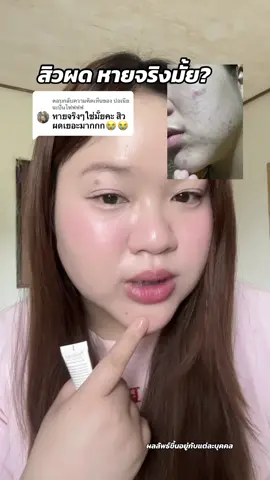 ตอบกลับ @ปอเนียจะปั่นไฟฟฟฟ ใช้เจลแต้มสิวโปรวาเมด สิวผด หายจริงมั้ย ?? #โปรวาเมด #provamed #ลดสิวผด #ลดสิวอุดตัน #สิวผด  @นุ่มน้อแน้  𐙚⋆  @นุ่มน้อแน้  𐙚⋆ 
