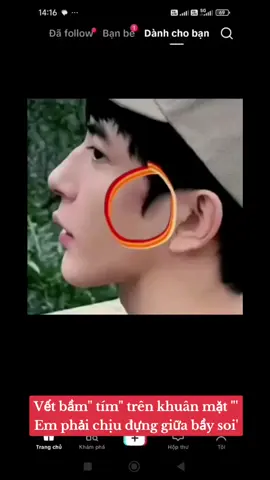 #yumonglung💔 #yumonglung #yumonglung🍋 #vumonglung🍋🍋 #vairal 2năm trở về đây nghe nói 17lần em nhâp viện 