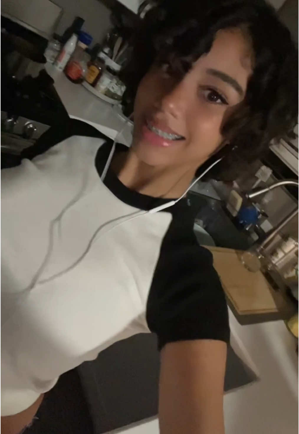 i feel so awkward with these metal plates on my teeth