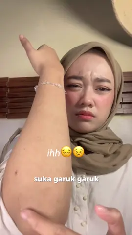 ihhh penyelamat bgt ciara ini❤️🫰🏻 #BekasLuka #Ruam #CreamBekasLuka #CreamGatal #CreamIritasi 