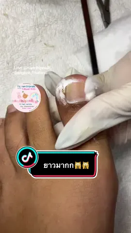 💓 #namthipnails #ตัดเล็บขบ #ตัดหนัง #ทำเล็บ #ร้านตัดเล็บขบ      Fb : namthipnails  Line : @namthipnails