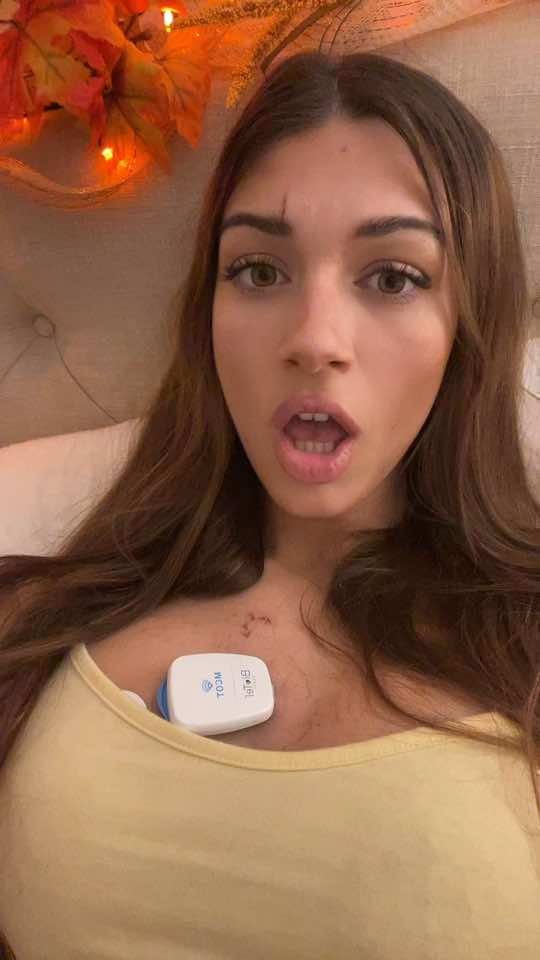 I literally got hit by a bus this day #lottery 