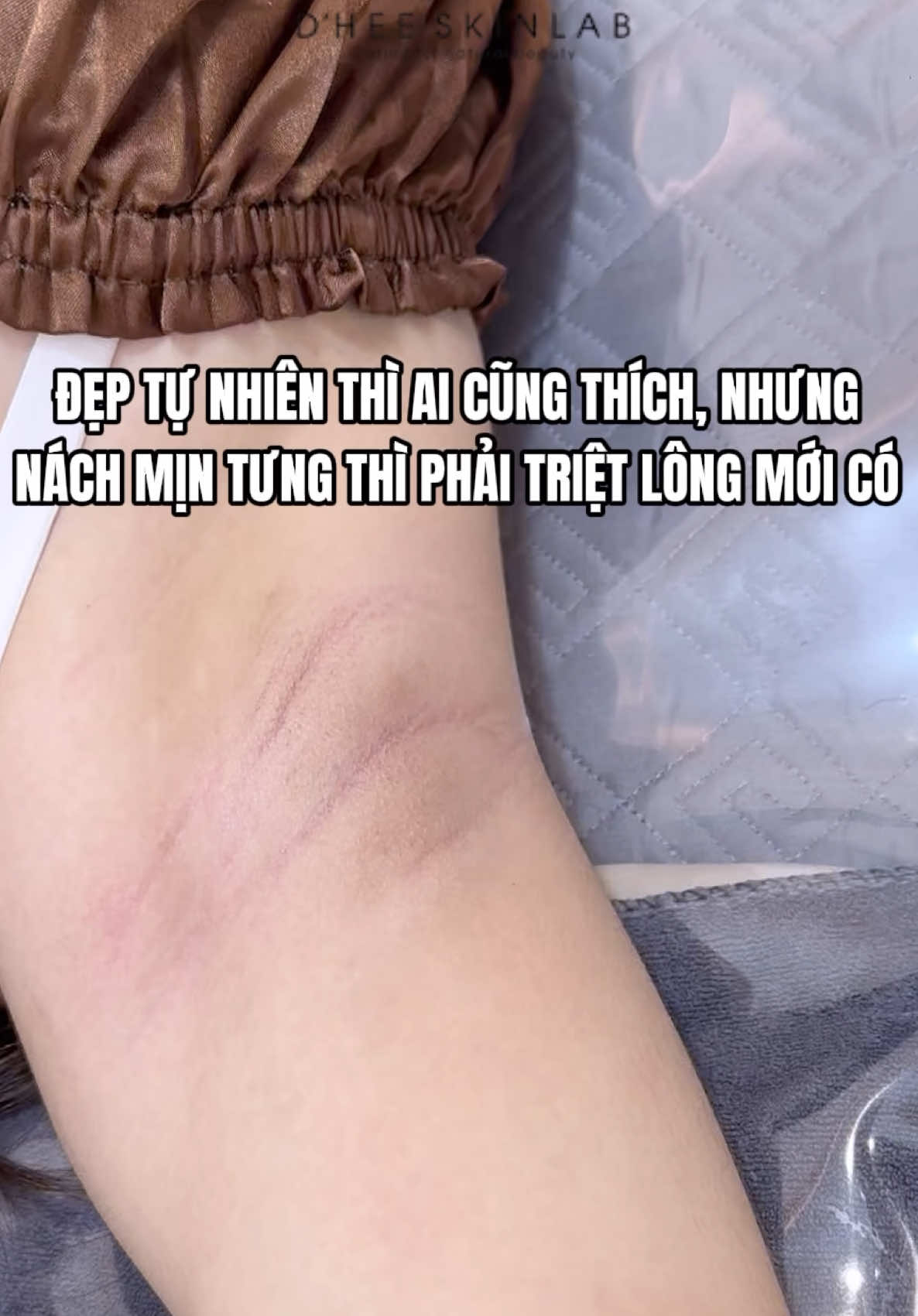 Một chiếc nách mịn tưng mà nàng nào cũng mê #reviewlamdep #trietlong #dheeskinlab #xh #trietlongnach 