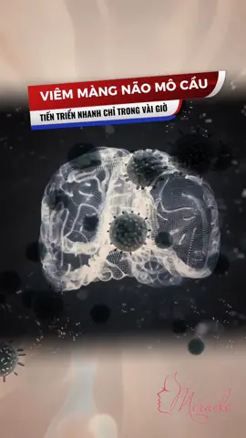 🔴Bệnh viêm màng não mô cầu  #Miracle #naomocau #viemmangnao #chamsocsuckhoe #kienthucsuckhoe