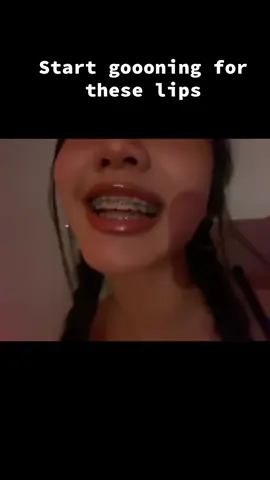 #fyp #foryou #viral #boptok #braces 
