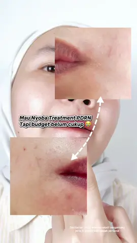 Mau coba treatment PDRN tapi budget belum cukup? Pakai YOU Barrier Serum ini aja. #YOURadianceSeries #YOUSkincare #YOUserum #serumYOU #YOUBarrier  