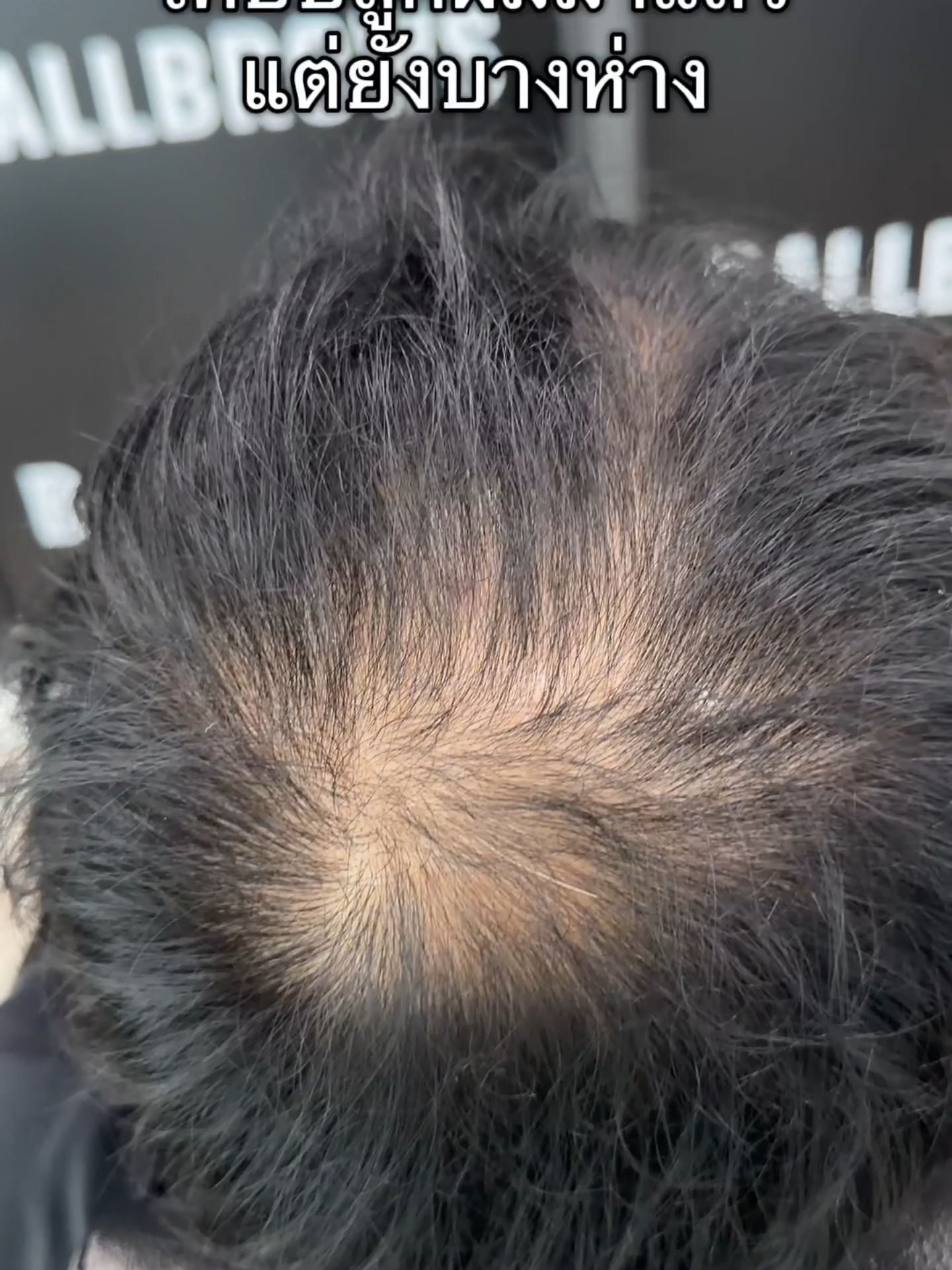 กันน้ำได้จริง ไม่เลอะ ไม่หลุด! ทดสอบแล้วแน่นสุด 💦#แป้งปิดผมบาง #กันน้ํากันเหงื่อ #รีวิวจริง #ของดีในtiktok #รีวิวจริง