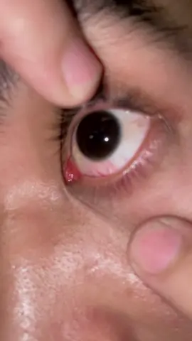 egone motoo angel tatananae ra gelem anteng 🥲