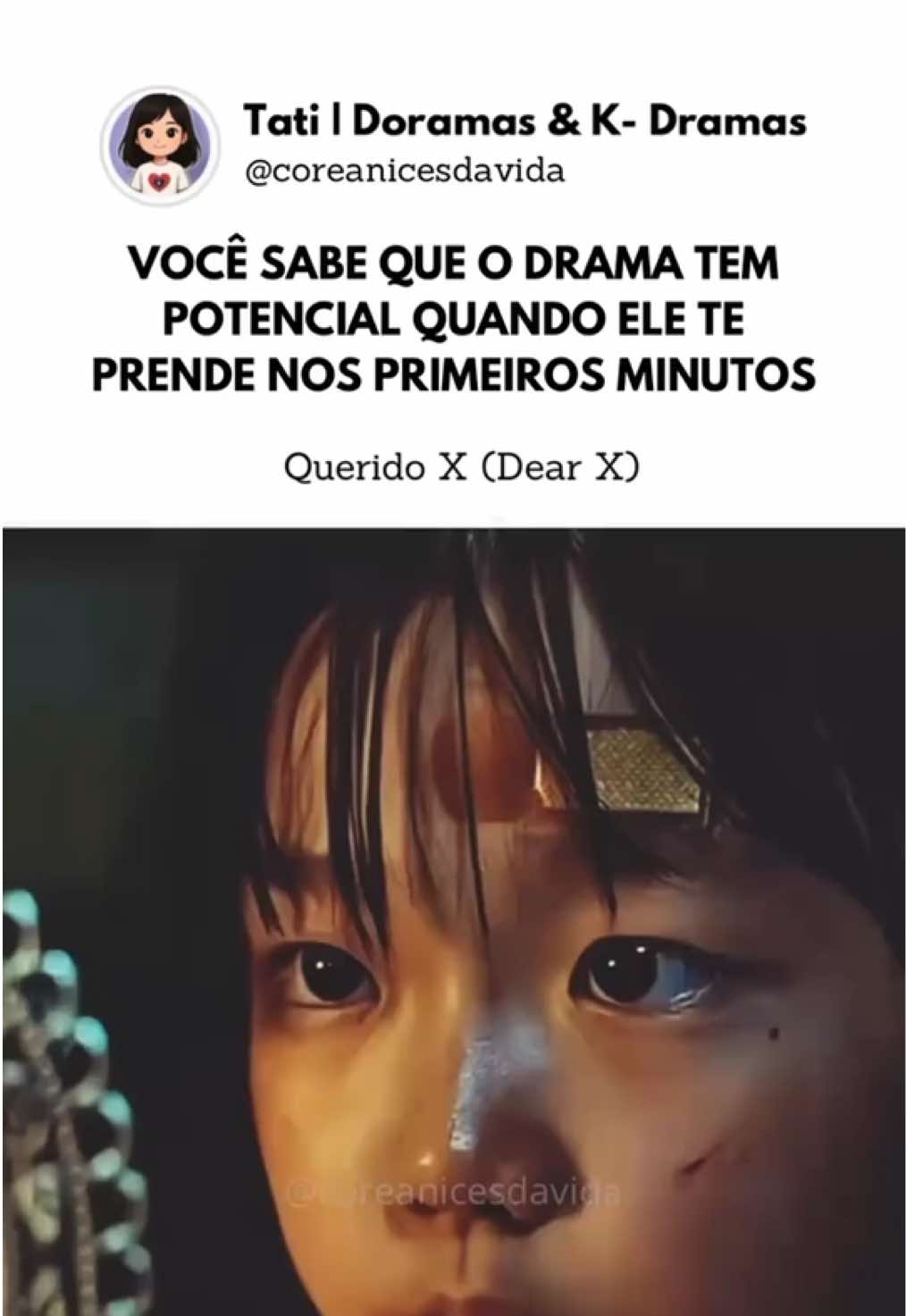 Você sente quando um drama vai ser diferente e Dear X prova isso logo nos primeiros minutos, tensão, mistério e uma história que promete Baek Ah-jin (Kim Yoo-jung) é o tipo de personagem que você não sabe se ama ou odeia… eu particularmente já estou preparada pra passar pano  📅 Nome: Dear X (querido X) 📺 Onde assistir: Viki Se você ama doramas, k-pop e atores coreanos, já salva esse reels e compartilha com sua amiga dorameira! 💕 👉 Curte, comenta e segue @coreanicesdavida para mais conteúdos sobre doramas e k-dramas! . . . . #kdrama #doramas #dorama #kdramaedits #dearx 
