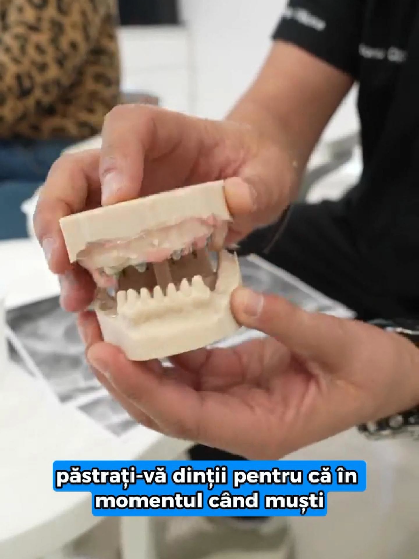 🦷 Dragi români, păstrați-vă dinții! Pentru că, în momentul în care muști și simți, e semnul că încă ești sănătos. Iar acei 6-7 dinți naturali, chiar și după 20 de ani, pot fi salvați și susținuți cu implanturi — dacă le oferim o șansă. 👉 În multe cazuri, primul impuls este: „hai să-i scot pe toți și pun implanturi”. Dar adevărul este că nu întotdeauna e nevoie. De multe ori, acei dinți încă pot fi tratați, reabilitați și integrați într-o lucrare completă. Cazul Ionelei este dovada vie: 👩‍🦰 Primii dinți pierduți la 26 de ani, 🦷 Prima lucrare acum 16 ani, 😔 După ani de punți și lucrări temporare – a ajuns să nu mai aibă deloc dinți. Astăzi, la Denta Clinic, are o lucrare fixă completă pe 6 implanturi sus și 6 jos, realizată în doar 2 zile de tratamente și o a treia ședință pentru lucrarea finală. ✅ Așa arată reabilitarea completă făcută corect, cu grijă și răbdare. Nu prin soluții rapide, nu prin compromisuri. 💬 „Fast & Fix nu e ieftin, dar e corect. E o investiție pentru următorii 20 de ani.” Pentru că adevărata economie nu este să cauți cel mai mic preț. Ci să-ți păstrezi ce ți-a dat Dumnezeu — dinții tăi naturali, atât cât se mai poate. 🌿 📍 Denta Clinic – Calea București 193A, Râmnicu Vâlcea 📞 WhatsApp: +40 761 233 220 🌐 www.dentaclinic.ro 🔗 linktr.ee/dentaclinic.vl #DentaClinic #ZambetNatural #ImplanturiDentare #FastAndFix #ReabilitareTotala #ZambetCuIncredere #EchipaDentaClinic #PacientiFericiti