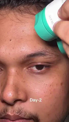 @PURITO SEOUL #Purito #PanthenolCream #RealPostAcneCream #koreanskincare #nomoremarkschallenge 