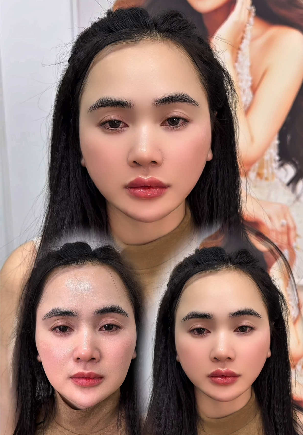 Nếu sắc đẹp là đặc quyền thì sự tự tin chính là vũ k.hí của chị em phụ nữ chúng mình. Mời cả nhà cùng Thuỷ xem thành quả ca cân chỉnh khuôn mặt cho chị gái khách hàng tại Dora nha. INBOX để Thuỷ tư vấn trực tiếp dịch vụ làm đẹp phù hợp dành cho bạn 🥰 #filler #cangchi #lamdep #viral #fyp 