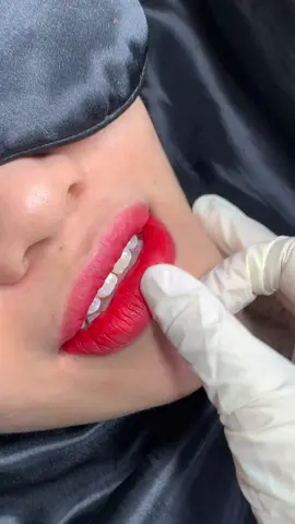 Khử thâm môi.. môi này Tram xử lí với 2chum mực thuii #khuthammoibinhthanh #phunmôitựnhiênbìnhthạnh 